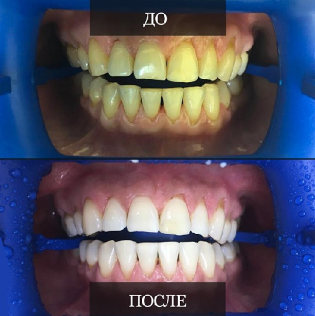 ZOOM 4
