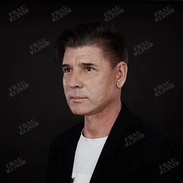 Фейслифтинг