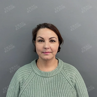 Фейслифтинг