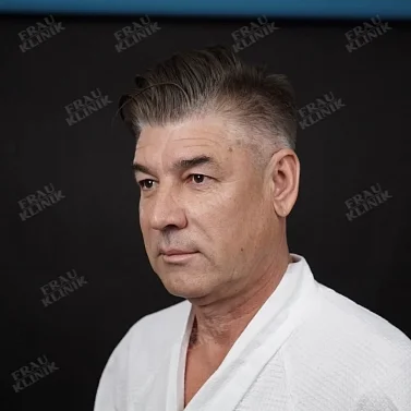 Фейслифтинг