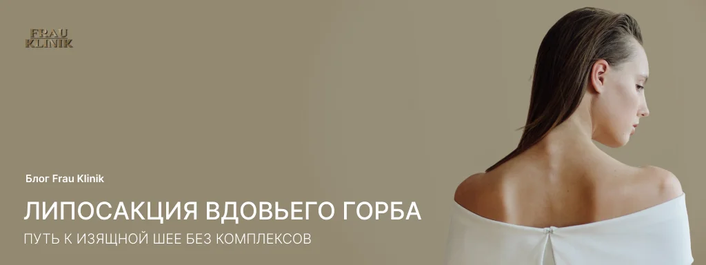 Липосакция вдовьего горба: путь к изящной шее без комплексов