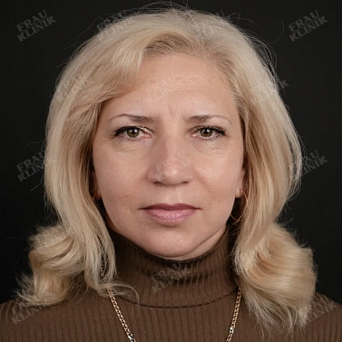 Фейслифтинг