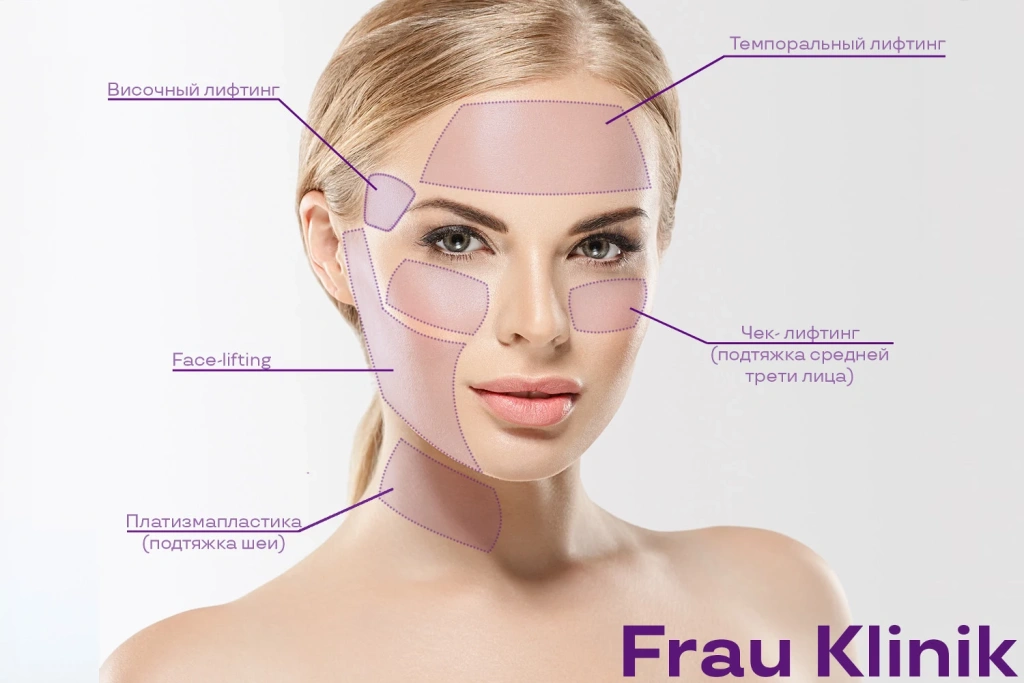 frauklinik_facelifting.webp