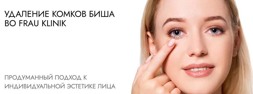 udalenie_komkov_bisha_frauklinik.webp