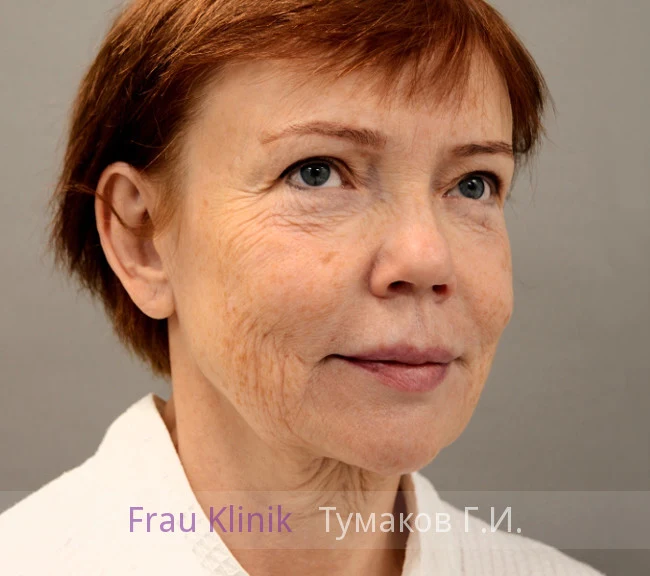 040-do.webp 040-do.webp