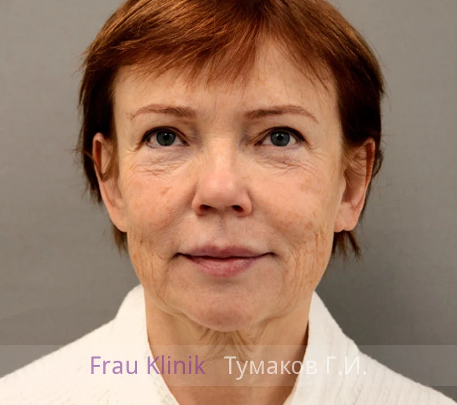 39-do.webp 39-do.webp