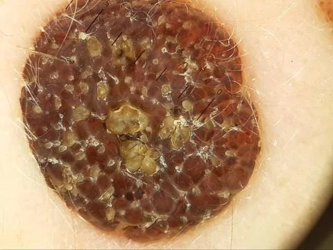 rodinki-novobrazovaniya-frauklinik.webp