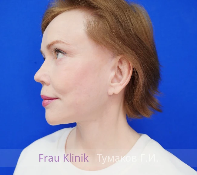 deep-smas-svetlana-16.webp deep-smas-svetlana-16.webp