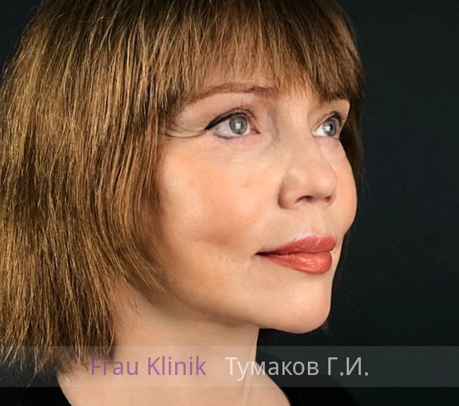 040-posle.webp 040-posle.webp