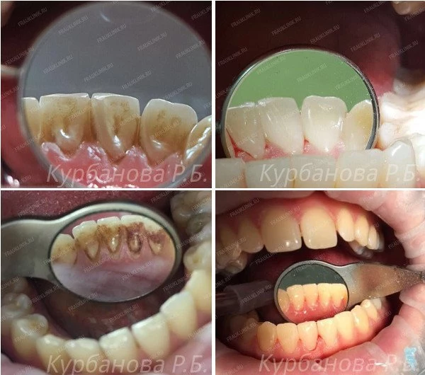 Курбанова Р.Б.