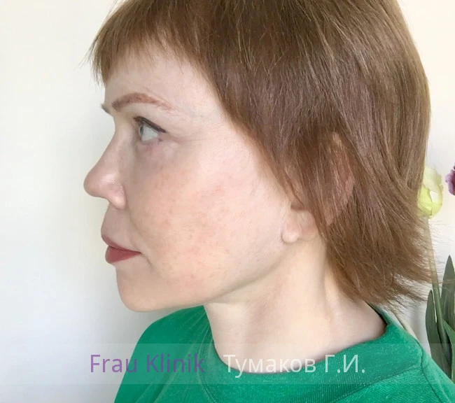 deep-smas-svetlana-10.webp deep-smas-svetlana-10.webp