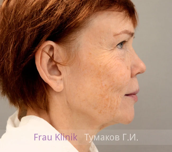 041-do.webp 041-do.webp