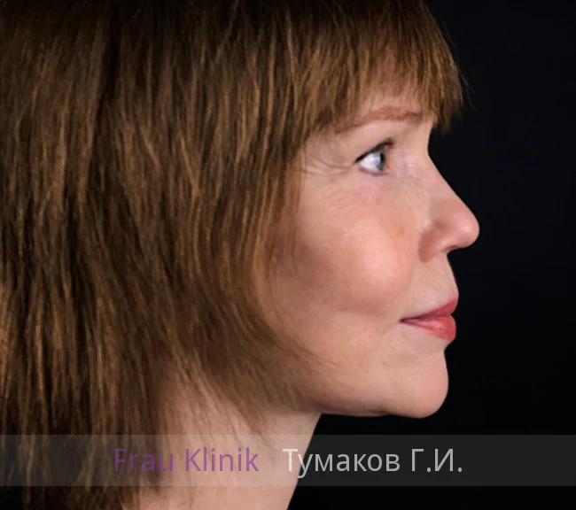 041-posle.webp 041-posle.webp