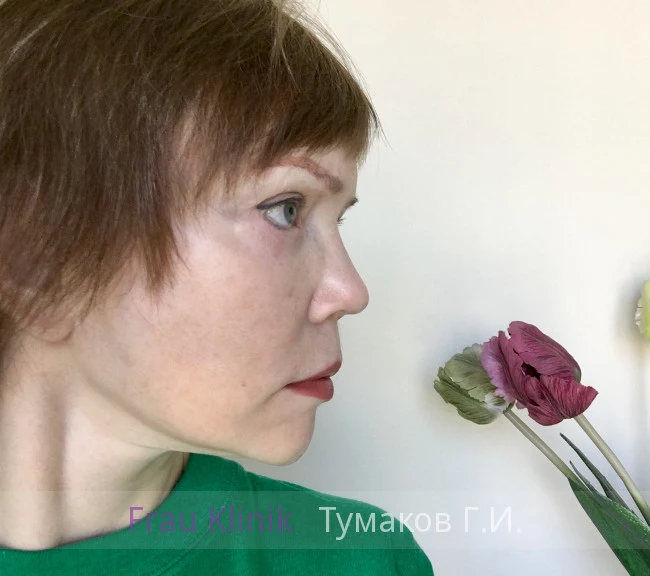 deep-smas-svetlana-9.webp deep-smas-svetlana-9.webp