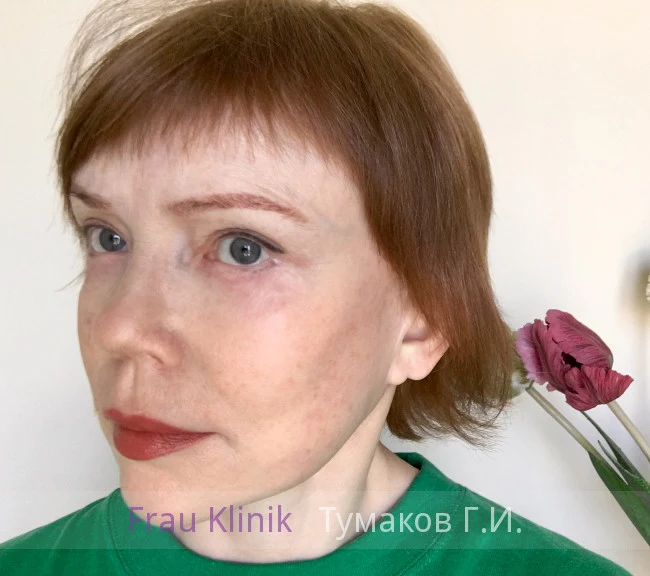 deep-smas-svetlana-12.webp deep-smas-svetlana-12.webp