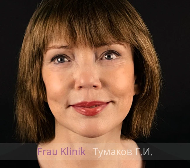 39-posle.webp 39-posle.webp