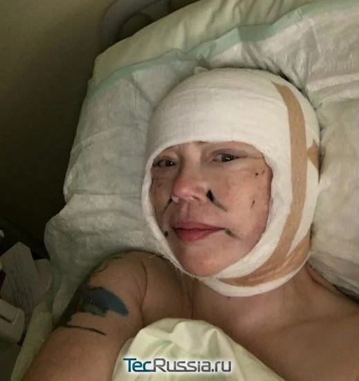 deep-smas-svetlana-4.webp deep-smas-svetlana-4.webp