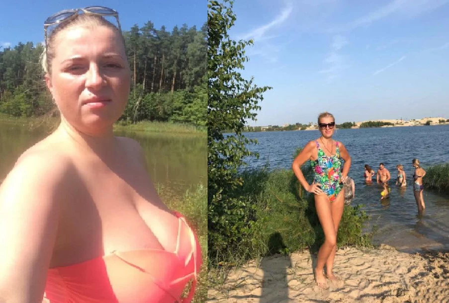 frauklinik_torsoplastika.webp