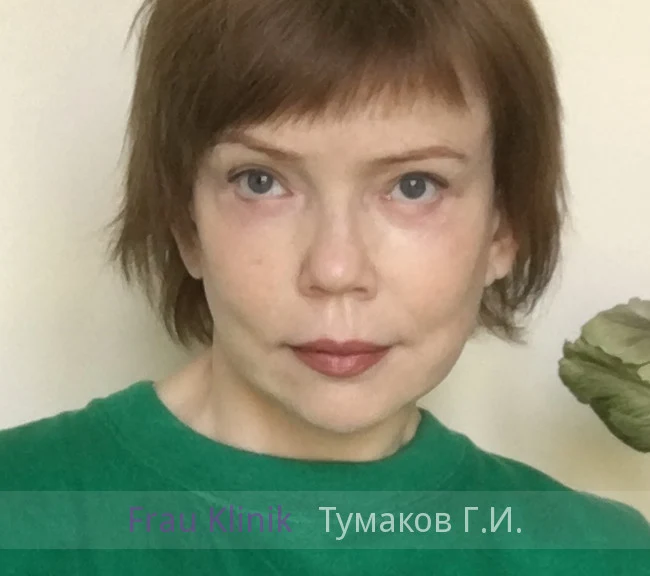 deep-smas-svetlana-13.webp deep-smas-svetlana-13.webp