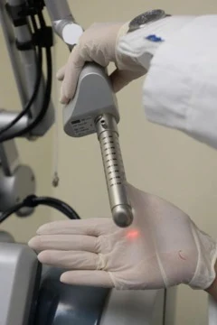 лазерная процедура MonaLisa Touch™ (Мона Лиза Тач)