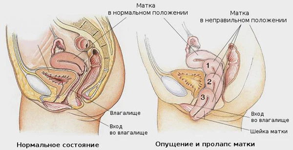 Зуд и жжение во влагалище: причины, симптомы и лечение